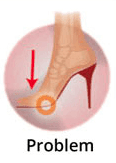 FootLogics Catwalk Orthotics for High heels - InterAktivWear